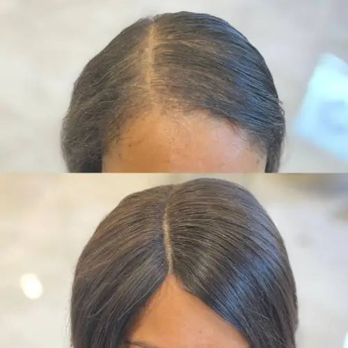 Mesh Integration Hairline Course