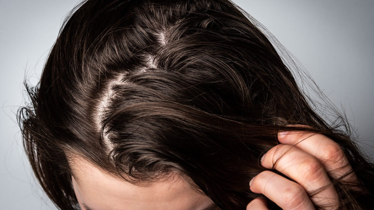 Why Does My Hair Get Greasy So Fast? Our Guide To Greasy Hair