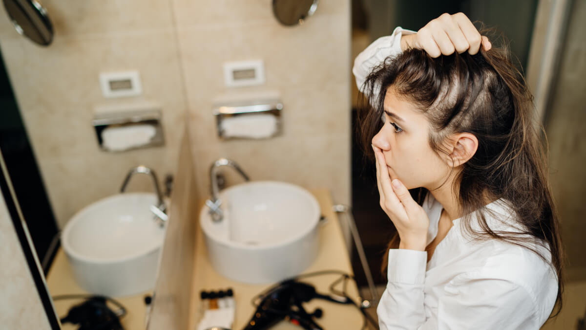 woman suffering hairloss